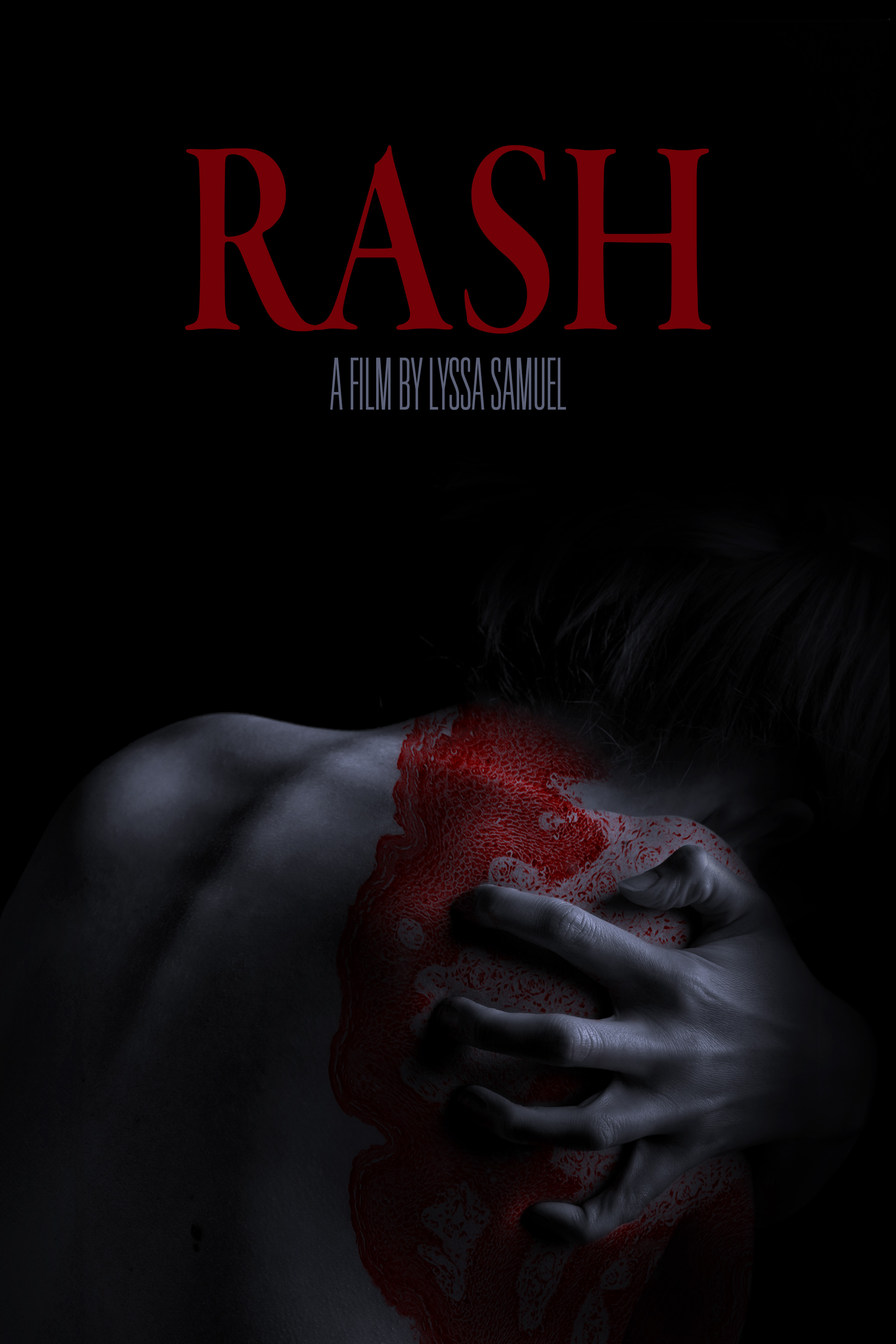 RASH